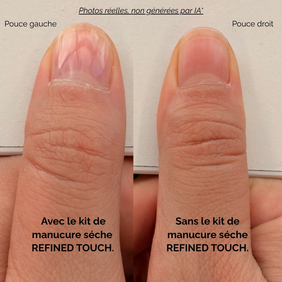 Comparatif ongles avec et sans le kit de manucure sèche REFINED TOUCH.